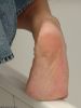 small preview pic number 32 from set 269 showing Allyoucanfeet model Jing