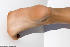 small preview pic number 153 from set 3079 showing Allyoucanfeet model Nancy