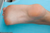 small preview pic number 40 from set 835 showing Allyoucanfeet model Dorinka